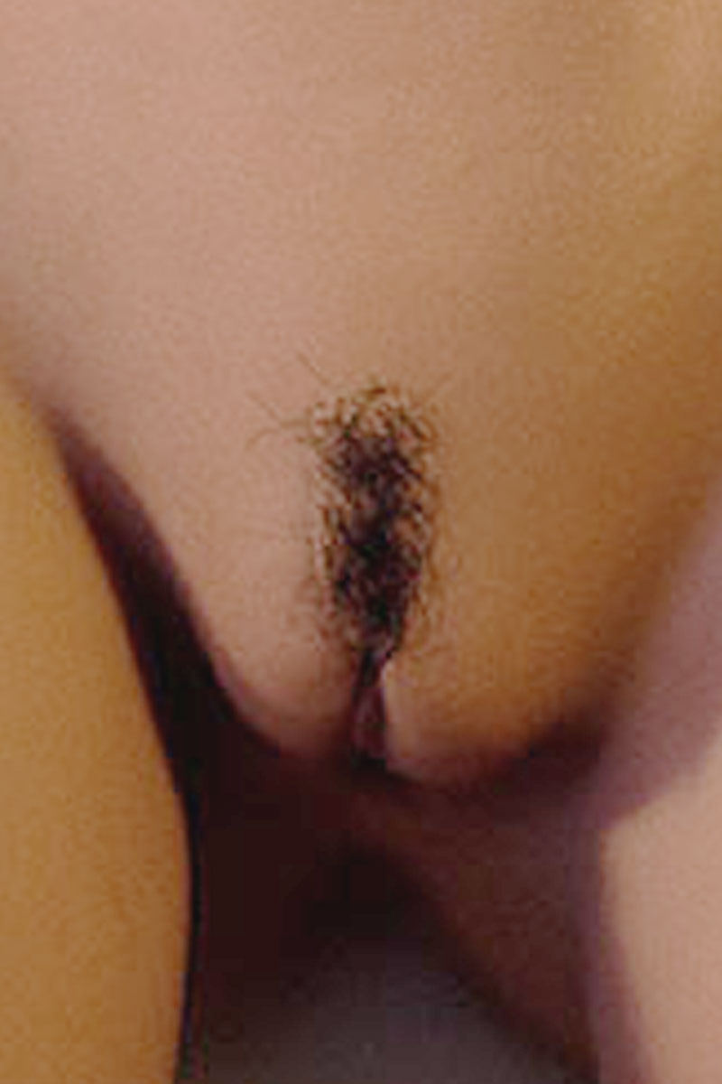 WM Doll Upgrade: Pubic Hair Implant