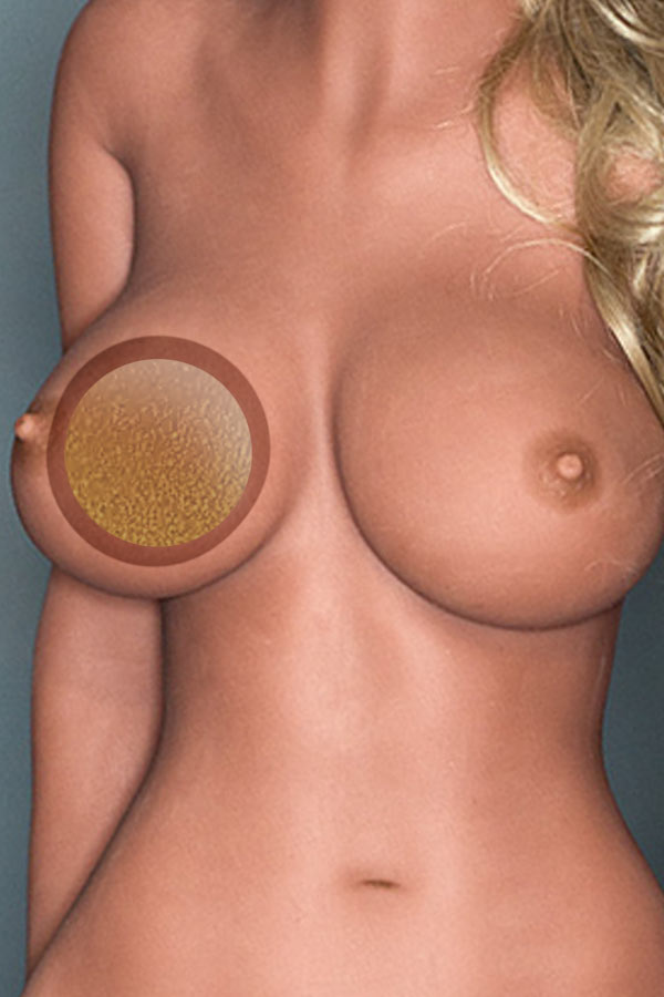 WM Doll Upgrade: Gel-Filled Breasts